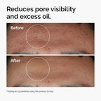 Before and after using Niacinamide 10% + Zinc 1% to reduce oil and minimize pores.